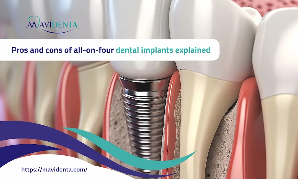 Pros and cons of all on four dental implants