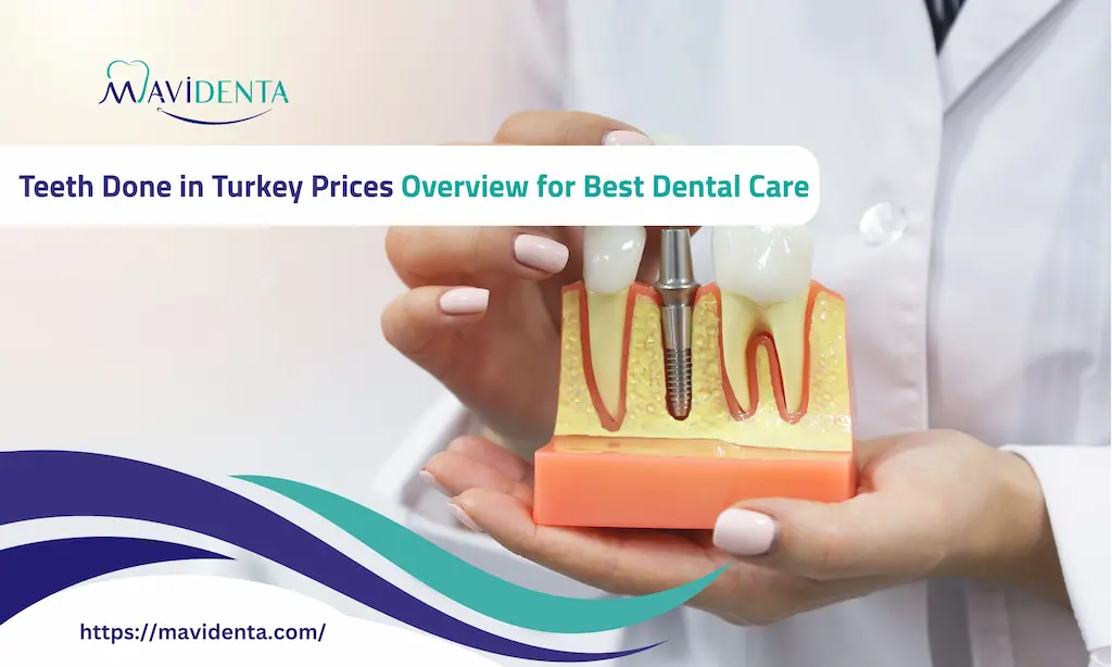 Teeth Done in Turkey Prices