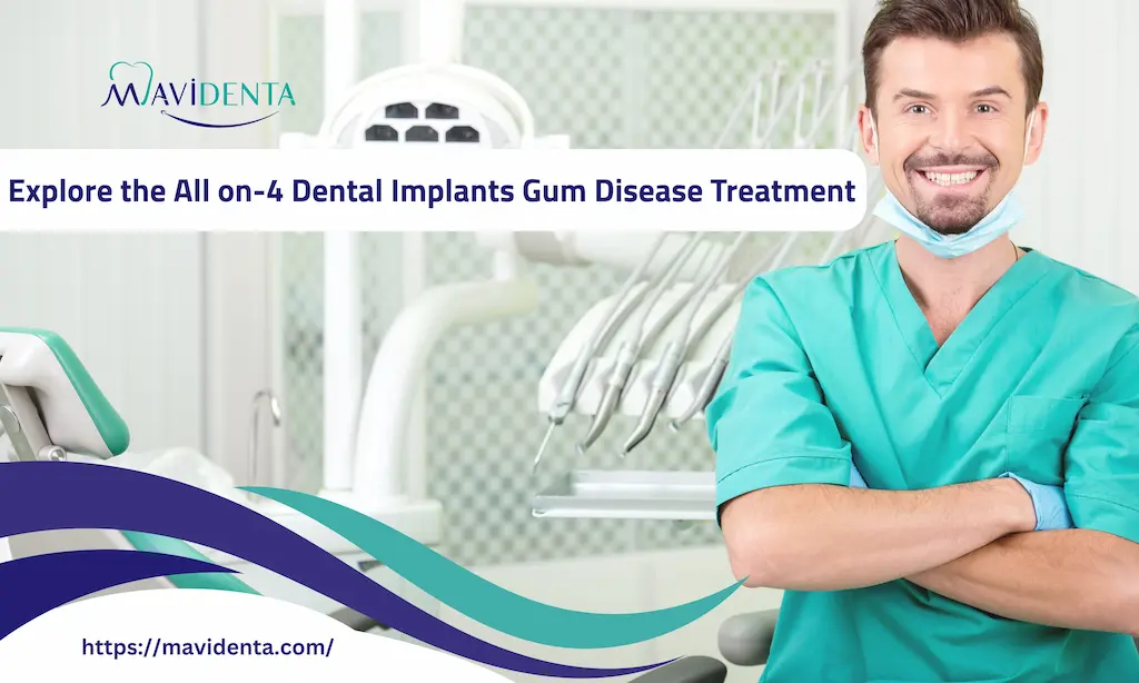 all on-4 dental implants gum disease​